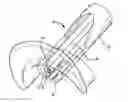 Fig. 01 - Mitral valve leaflet clip