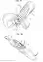 Fig. 09 - Mitral valve leaflet clip