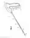 Fig. 02 - Surgical instrument for dispensing tacks and solution