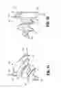 Fig. 10 - Surgical instrument for dispensing tacks and solution