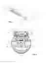 Fig. 02 - Uterine Artery Ligation Devices and Methods