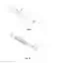 Fig. 07 - Uterine Artery Ligation Devices and Methods