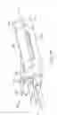 Fig. 28 - Suturing device and method for sealing an opening in a blood vessel or other biological structure