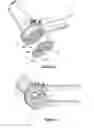 Fig. 06 - ANASTOMOTIC DEVICE AND METHOD
