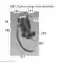 Fig. 11 - Means and methods for suturing tissue