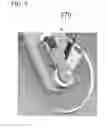 Fig. 12 - Means and methods for suturing tissue