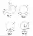 Fig. 02 - GASTRIC PLICATION GUIDE