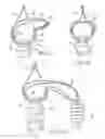 Fig. 05 - Method for implanting soft tissue