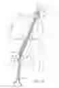 Fig. 07 - Method for implanting soft tissue