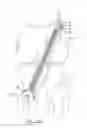 Fig. 08 - Method for implanting soft tissue