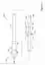Fig. 02 - Vibration and inertia enhanced atherectomy