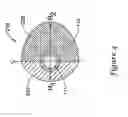 Fig. 04 - Vibration and inertia enhanced atherectomy
