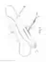 Fig. 02 - ROTATIONAL ATHERECTOMY DEVICE WITH BIASING CLUTCH