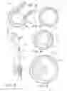 Fig. 02 - VASCULAR PLAQUE REMOVAL SYSTEMS, DEVICES, AND METHODS