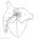 Fig. 01 - Devices, systems, and methods for treating heart failure