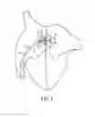 Fig. 02 - Devices, systems, and methods for treating heart failure