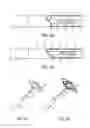 Fig. 04 - Devices, systems, and methods for treating heart failure