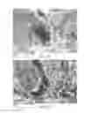 Fig. 07 - Tri-fluted vascular access needle