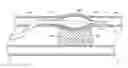 Fig. 01 - Subintimal re-entry catheter with shape controlled balloon
