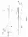 Fig. 02 - Subintimal re-entry catheter with shape controlled balloon