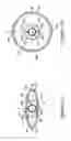 Fig. 08 - Subintimal re-entry catheter with shape controlled balloon
