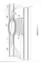 Fig. 14 - Subintimal re-entry catheter with shape controlled balloon