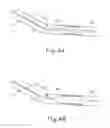 Fig. 04 - APPARATUS FOR PUNCTURING BALLOON IN AIRWAY DILATION SHAFT