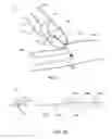 Fig. 02 - Removal tool for use with endoscopic device