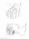 Fig. 02 - Clot retrieval devices