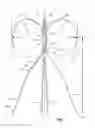 Fig. 02 - Removable vena cava filter having primary and secondary struts