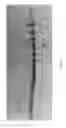 Fig. 89 - Woven radiopaque patterns