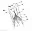 Fig. 01 - Vena cava filter removal device