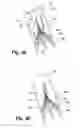 Fig. 03 - Vena cava filter removal device