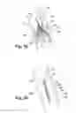 Fig. 04 - Vena cava filter removal device