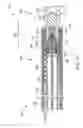 Fig. 09 - Vaso-occlusive device delivery system