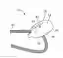 Fig. 01 - TISSUE ANCHORING AND DEPLOYMENT SYSTEMS