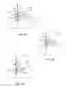 Fig. 09 - TISSUE ANCHORING AND DEPLOYMENT SYSTEMS