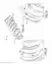 Fig. 08 - Fenestrated locking suture anchor assembly