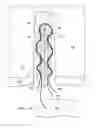 Fig. 03 - Tissue repair assembly