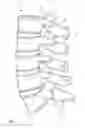 Fig. 02 - Apparatus for spinal fixation and methods of use