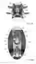 Fig. 09 - Apparatus for spinal fixation and methods of use