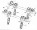 Fig. 01 - Percutaneous spinal cross link system and method