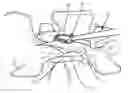 Fig. 01 - Spinal correction system and method
