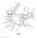 Fig. 07 - Spinal correction system and method