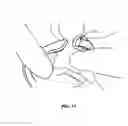 Fig. 09 - Spinal correction system and method