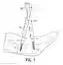 Fig. 02 - Fulcrum cap for spinal constructs