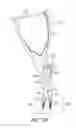 Fig. 11 - Fulcrum cap for spinal constructs