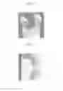 Fig. 11 - Locking compression members for use with bone anchor assemblies and methods