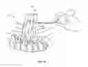Fig. 14 - Surgical implant system and method