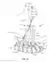 Fig. 18 - Surgical implant system and method